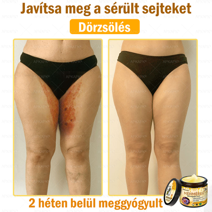 ✨💜💜APKAPK® 𝐌É𝐇𝐌É𝐑𝐄𝐆 Á𝐓𝐅𝐎𝐆Ó 𝐊𝐑É𝐌🥇𝐀 bőrnövedékek 𝐤𝐞𝐳𝐞𝐥é𝐬𝐞 𝐦𝐚𝐠á𝐛𝐚𝐧 𝐟𝐨𝐠𝐥𝐚𝐥𝐣𝐚: é𝐥𝐞𝐭𝐤𝐨𝐫𝐢 𝐟𝐨𝐥𝐭𝐨𝐤, 𝐡𝐞𝐠𝐞𝐤, 𝐬𝐳𝐞𝐦ö𝐥𝐜𝐬ö𝐤, 𝐛ö𝐫𝐧ö𝐯𝐞𝐝é𝐤𝐞𝐤, 𝐭á𝐥𝐲𝐨𝐠𝐨𝐤, 𝐩𝐚𝐭𝐭𝐚𝐧á𝐬𝐨𝐤, 𝐞𝐤𝐜é𝐦𝐚, 𝐩𝐬𝐨𝐫𝐢𝐚𝐬𝐢𝐬, 𝐚𝐜𝐧𝐞 𝐢𝐧𝐯𝐞𝐫𝐬𝐚, 𝐫á𝐧𝐜𝐨𝐤, 𝐛ö𝐫ö𝐫𝐞𝐠𝐞𝐝é𝐬 é𝐬 𝐞𝐠𝐲é𝐛 𝐩𝐫𝐨𝐛𝐥é𝐦á𝐤🔥