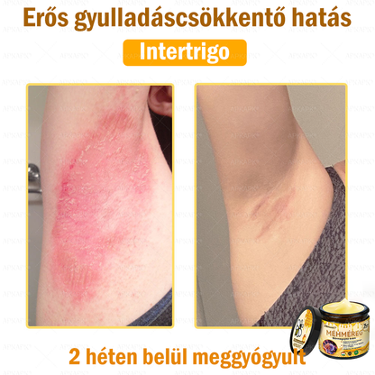 ✨💜💜APKAPK® 𝐌É𝐇𝐌É𝐑𝐄𝐆 Á𝐓𝐅𝐎𝐆Ó 𝐊𝐑É𝐌🥇𝐀 bőrnövedékek 𝐤𝐞𝐳𝐞𝐥é𝐬𝐞 𝐦𝐚𝐠á𝐛𝐚𝐧 𝐟𝐨𝐠𝐥𝐚𝐥𝐣𝐚: é𝐥𝐞𝐭𝐤𝐨𝐫𝐢 𝐟𝐨𝐥𝐭𝐨𝐤, 𝐡𝐞𝐠𝐞𝐤, 𝐬𝐳𝐞𝐦ö𝐥𝐜𝐬ö𝐤, 𝐛ö𝐫𝐧ö𝐯𝐞𝐝é𝐤𝐞𝐤, 𝐭á𝐥𝐲𝐨𝐠𝐨𝐤, 𝐩𝐚𝐭𝐭𝐚𝐧á𝐬𝐨𝐤, 𝐞𝐤𝐜é𝐦𝐚, 𝐩𝐬𝐨𝐫𝐢𝐚𝐬𝐢𝐬, 𝐚𝐜𝐧𝐞 𝐢𝐧𝐯𝐞𝐫𝐬𝐚, 𝐫á𝐧𝐜𝐨𝐤, 𝐛ö𝐫ö𝐫𝐞𝐠𝐞𝐝é𝐬 é𝐬 𝐞𝐠𝐲é𝐛 𝐩𝐫𝐨𝐛𝐥é𝐦á𝐤🔥
