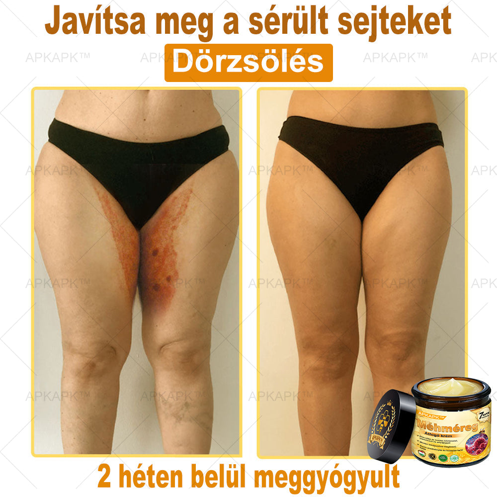 ✨🥇𝐀𝐏𝐊𝐀𝐏𝐊® 𝐌É𝐇𝐌É𝐑𝐄𝐆 Á𝐓𝐅𝐎𝐆Ó 𝐊𝐑É𝐌🥇𝐀 𝐛ö𝐫𝐩𝐫𝐨𝐛𝐥é𝐦á𝐤 𝐤𝐞𝐳𝐞𝐥é𝐬𝐞 𝐦𝐚𝐠á𝐛𝐚𝐧 𝐟𝐨𝐠𝐥𝐚𝐥𝐣𝐚: é𝐥𝐞𝐭𝐤𝐨𝐫𝐢 𝐟𝐨𝐥𝐭𝐨𝐤, 𝐡𝐞𝐠𝐞𝐤, 𝐬𝐳𝐞𝐦ö𝐥𝐜𝐬ö𝐤, 𝐛ö𝐫𝐧ö𝐯𝐞𝐝é𝐤𝐞𝐤, 𝐭á𝐥𝐲𝐨𝐠𝐨𝐤, 𝐩𝐚𝐭𝐭𝐚𝐧á𝐬𝐨𝐤, 𝐞𝐤𝐜é𝐦𝐚, 𝐩𝐬𝐨𝐫𝐢𝐚𝐬𝐢𝐬, 𝐚𝐜𝐧𝐞 𝐢𝐧𝐯𝐞𝐫𝐬𝐚, 𝐫á𝐧𝐜𝐨𝐤, 𝐛ö𝐫ö𝐫𝐞𝐠𝐞𝐝é𝐬 é𝐬 𝐞𝐠𝐲é𝐛 𝐩𝐫𝐨𝐛𝐥é𝐦á𝐤🔥