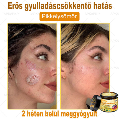 ✨🥇𝐀𝐏𝐊𝐀𝐏𝐊® 𝐌É𝐇𝐌É𝐑𝐄𝐆 Á𝐓𝐅𝐎𝐆Ó 𝐊𝐑É𝐌🥇𝐀 𝐛ö𝐫𝐩𝐫𝐨𝐛𝐥é𝐦á𝐤 𝐤𝐞𝐳𝐞𝐥é𝐬𝐞 𝐦𝐚𝐠á𝐛𝐚𝐧 𝐟𝐨𝐠𝐥𝐚𝐥𝐣𝐚: é𝐥𝐞𝐭𝐤𝐨𝐫𝐢 𝐟𝐨𝐥𝐭𝐨𝐤, 𝐡𝐞𝐠𝐞𝐤, 𝐬𝐳𝐞𝐦ö𝐥𝐜𝐬ö𝐤, 𝐛ö𝐫𝐧ö𝐯𝐞𝐝é𝐤𝐞𝐤, 𝐭á𝐥𝐲𝐨𝐠𝐨𝐤, 𝐩𝐚𝐭𝐭𝐚𝐧á𝐬𝐨𝐤, 𝐞𝐤𝐜é𝐦𝐚, 𝐩𝐬𝐨𝐫𝐢𝐚𝐬𝐢𝐬, 𝐚𝐜𝐧𝐞 𝐢𝐧𝐯𝐞𝐫𝐬𝐚, 𝐫á𝐧𝐜𝐨𝐤, 𝐛ö𝐫ö𝐫𝐞𝐠𝐞𝐝é𝐬 é𝐬 𝐞𝐠𝐲é𝐛 𝐩𝐫𝐨𝐛𝐥é𝐦á𝐤🔥