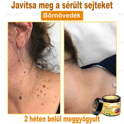 ✨🥇𝐀𝐏𝐊𝐀𝐏𝐊® 𝐌É𝐇𝐌É𝐑𝐄𝐆 Á𝐓𝐅𝐎𝐆Ó 𝐊𝐑É𝐌🥇𝐀 𝐛ö𝐫𝐩𝐫𝐨𝐛𝐥é𝐦á𝐤 𝐤𝐞𝐳𝐞𝐥é𝐬𝐞 𝐦𝐚𝐠á𝐛𝐚𝐧 𝐟𝐨𝐠𝐥𝐚𝐥𝐣𝐚: é𝐥𝐞𝐭𝐤𝐨𝐫𝐢 𝐟𝐨𝐥𝐭𝐨𝐤, 𝐡𝐞𝐠𝐞𝐤, 𝐬𝐳𝐞𝐦ö𝐥𝐜𝐬ö𝐤, 𝐛ö𝐫𝐧ö𝐯𝐞𝐝é𝐤𝐞𝐤, 𝐭á𝐥𝐲𝐨𝐠𝐨𝐤, 𝐩𝐚𝐭𝐭𝐚𝐧á𝐬𝐨𝐤, 𝐞𝐤𝐜é𝐦𝐚, 𝐩𝐬𝐨𝐫𝐢𝐚𝐬𝐢𝐬, 𝐚𝐜𝐧𝐞 𝐢𝐧𝐯𝐞𝐫𝐬𝐚, 𝐫á𝐧𝐜𝐨𝐤, 𝐛ö𝐫ö𝐫𝐞𝐠𝐞𝐝é𝐬 é𝐬 𝐞𝐠𝐲é𝐛 𝐩𝐫𝐨𝐛𝐥é𝐦á𝐤🔥
