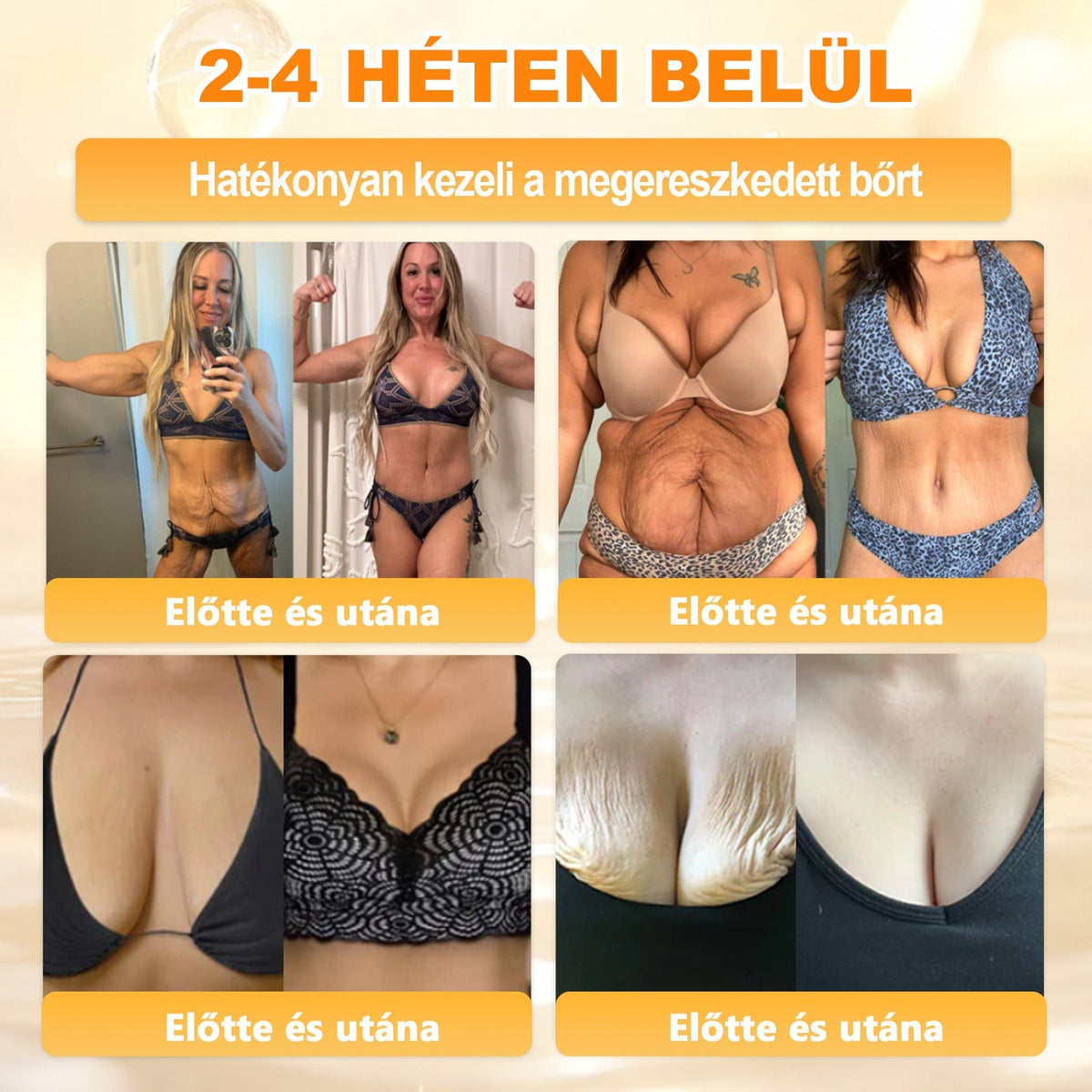 👩‍⚕️👩‍⚕️ 𝐀𝐏𝐊𝐀𝐏𝐊® Természetes Méhméreges Arckrém – gondosan összeállított formula a bőr táplálására, hidratálására és regeneráló ápolására