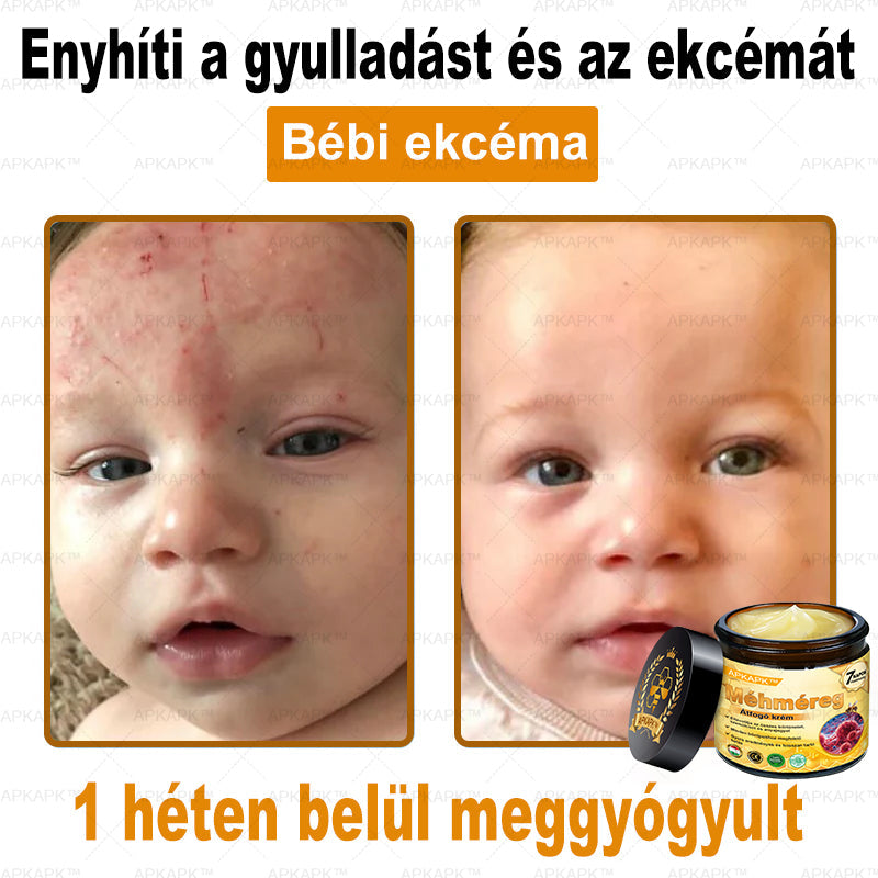 ✨🥇𝐀𝐏𝐊𝐀𝐏𝐊® 𝐌É𝐇𝐌É𝐑𝐄𝐆 Á𝐓𝐅𝐎𝐆Ó 𝐊𝐑É𝐌🥇𝐀 𝐛ö𝐫𝐩𝐫𝐨𝐛𝐥é𝐦á𝐤 𝐤𝐞𝐳𝐞𝐥é𝐬𝐞 𝐦𝐚𝐠á𝐛𝐚𝐧 𝐟𝐨𝐠𝐥𝐚𝐥𝐣𝐚: é𝐥𝐞𝐭𝐤𝐨𝐫𝐢 𝐟𝐨𝐥𝐭𝐨𝐤, 𝐡𝐞𝐠𝐞𝐤, 𝐬𝐳𝐞𝐦ö𝐥𝐜𝐬ö𝐤, 𝐛ö𝐫𝐧ö𝐯𝐞𝐝é𝐤𝐞𝐤, 𝐭á𝐥𝐲𝐨𝐠𝐨𝐤, 𝐩𝐚𝐭𝐭𝐚𝐧á𝐬𝐨𝐤, 𝐞𝐤𝐜é𝐦𝐚, 𝐩𝐬𝐨𝐫𝐢𝐚𝐬𝐢𝐬, 𝐚𝐜𝐧𝐞 𝐢𝐧𝐯𝐞𝐫𝐬𝐚, 𝐫á𝐧𝐜𝐨𝐤, 𝐛ö𝐫ö𝐫𝐞𝐠𝐞𝐝é𝐬 é𝐬 𝐞𝐠𝐲é𝐛 𝐩𝐫𝐨𝐛𝐥é𝐦á𝐤🔥