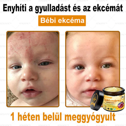 ✨🥇𝐀𝐏𝐊𝐀𝐏𝐊® 𝐌É𝐇𝐌É𝐑𝐄𝐆 Á𝐓𝐅𝐎𝐆Ó 𝐊𝐑É𝐌🥇𝐀 𝐛ö𝐫𝐩𝐫𝐨𝐛𝐥é𝐦á𝐤 𝐤𝐞𝐳𝐞𝐥é𝐬𝐞 𝐦𝐚𝐠á𝐛𝐚𝐧 𝐟𝐨𝐠𝐥𝐚𝐥𝐣𝐚: é𝐥𝐞𝐭𝐤𝐨𝐫𝐢 𝐟𝐨𝐥𝐭𝐨𝐤, 𝐡𝐞𝐠𝐞𝐤, 𝐬𝐳𝐞𝐦ö𝐥𝐜𝐬ö𝐤, 𝐛ö𝐫𝐧ö𝐯𝐞𝐝é𝐤𝐞𝐤, 𝐭á𝐥𝐲𝐨𝐠𝐨𝐤, 𝐩𝐚𝐭𝐭𝐚𝐧á𝐬𝐨𝐤, 𝐞𝐤𝐜é𝐦𝐚, 𝐩𝐬𝐨𝐫𝐢𝐚𝐬𝐢𝐬, 𝐚𝐜𝐧𝐞 𝐢𝐧𝐯𝐞𝐫𝐬𝐚, 𝐫á𝐧𝐜𝐨𝐤, 𝐛ö𝐫ö𝐫𝐞𝐠𝐞𝐝é𝐬 é𝐬 𝐞𝐠𝐲é𝐛 𝐩𝐫𝐨𝐛𝐥é𝐦á𝐤🔥