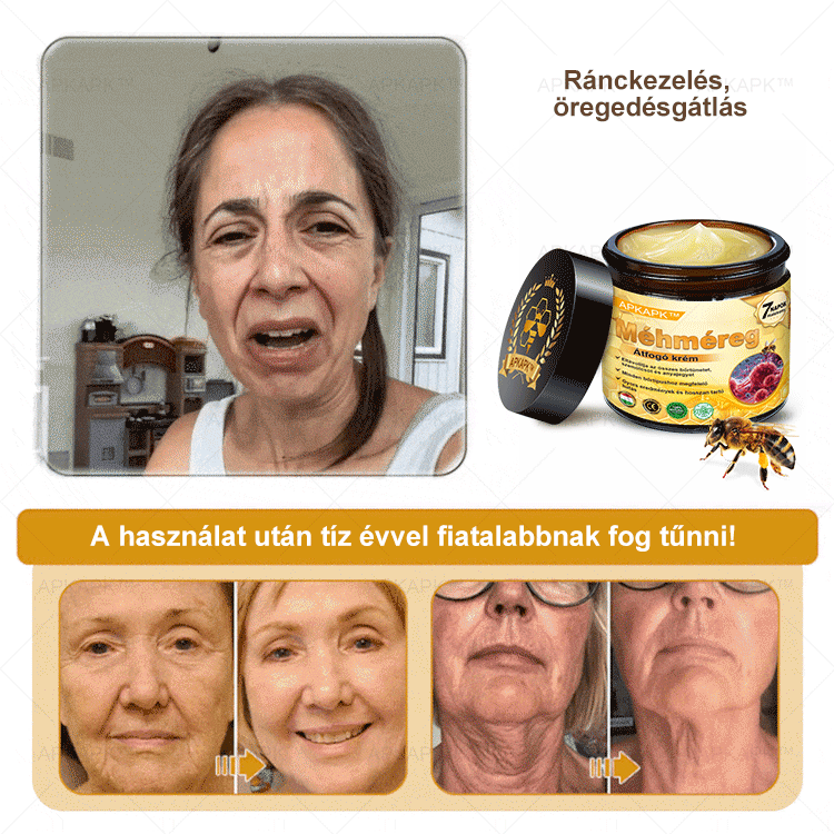 ✨🥇𝐀𝐏𝐊𝐀𝐏𝐊® 𝐌É𝐇𝐌É𝐑𝐄𝐆 Á𝐓𝐅𝐎𝐆Ó 𝐊𝐑É𝐌🥇𝐀 𝐛ö𝐫𝐩𝐫𝐨𝐛𝐥é𝐦á𝐤 𝐤𝐞𝐳𝐞𝐥é𝐬𝐞 𝐦𝐚𝐠á𝐛𝐚𝐧 𝐟𝐨𝐠𝐥𝐚𝐥𝐣𝐚: é𝐥𝐞𝐭𝐤𝐨𝐫𝐢 𝐟𝐨𝐥𝐭𝐨𝐤, 𝐡𝐞𝐠𝐞𝐤, 𝐬𝐳𝐞𝐦ö𝐥𝐜𝐬ö𝐤, 𝐛ö𝐫𝐧ö𝐯𝐞𝐝é𝐤𝐞𝐤, 𝐭á𝐥𝐲𝐨𝐠𝐨𝐤, 𝐩𝐚𝐭𝐭𝐚𝐧á𝐬𝐨𝐤, 𝐞𝐤𝐜é𝐦𝐚, 𝐩𝐬𝐨𝐫𝐢𝐚𝐬𝐢𝐬, 𝐚𝐜𝐧𝐞 𝐢𝐧𝐯𝐞𝐫𝐬𝐚, 𝐫á𝐧𝐜𝐨𝐤, 𝐛ö𝐫ö𝐫𝐞𝐠𝐞𝐝é𝐬 é𝐬 𝐞𝐠𝐲é𝐛 𝐩𝐫𝐨𝐛𝐥é𝐦á𝐤🔥