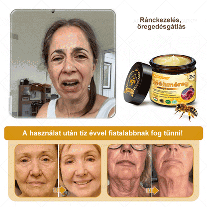 ✨🥇𝐀𝐏𝐊𝐀𝐏𝐊® 𝐌É𝐇𝐌É𝐑𝐄𝐆 Á𝐓𝐅𝐎𝐆Ó 𝐊𝐑É𝐌🥇𝐀 𝐛ö𝐫𝐩𝐫𝐨𝐛𝐥é𝐦á𝐤 𝐤𝐞𝐳𝐞𝐥é𝐬𝐞 𝐦𝐚𝐠á𝐛𝐚𝐧 𝐟𝐨𝐠𝐥𝐚𝐥𝐣𝐚: é𝐥𝐞𝐭𝐤𝐨𝐫𝐢 𝐟𝐨𝐥𝐭𝐨𝐤, 𝐡𝐞𝐠𝐞𝐤, 𝐬𝐳𝐞𝐦ö𝐥𝐜𝐬ö𝐤, 𝐛ö𝐫𝐧ö𝐯𝐞𝐝é𝐤𝐞𝐤, 𝐭á𝐥𝐲𝐨𝐠𝐨𝐤, 𝐩𝐚𝐭𝐭𝐚𝐧á𝐬𝐨𝐤, 𝐞𝐤𝐜é𝐦𝐚, 𝐩𝐬𝐨𝐫𝐢𝐚𝐬𝐢𝐬, 𝐚𝐜𝐧𝐞 𝐢𝐧𝐯𝐞𝐫𝐬𝐚, 𝐫á𝐧𝐜𝐨𝐤, 𝐛ö𝐫ö𝐫𝐞𝐠𝐞𝐝é𝐬 é𝐬 𝐞𝐠𝐲é𝐛 𝐩𝐫𝐨𝐛𝐥é𝐦á𝐤🔥
