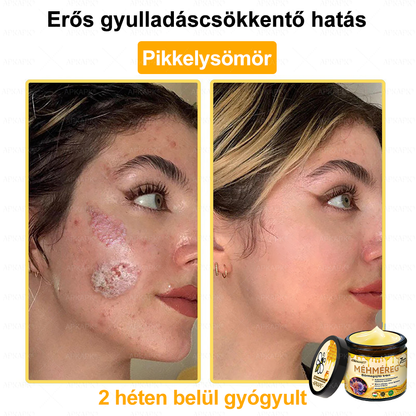 ✨💜💜APKAPK® 𝐌É𝐇𝐌É𝐑𝐄𝐆 Á𝐓𝐅𝐎𝐆Ó 𝐊𝐑É𝐌🥇𝐀 bőrnövedékek 𝐤𝐞𝐳𝐞𝐥é𝐬𝐞 𝐦𝐚𝐠á𝐛𝐚𝐧 𝐟𝐨𝐠𝐥𝐚𝐥𝐣𝐚: é𝐥𝐞𝐭𝐤𝐨𝐫𝐢 𝐟𝐨𝐥𝐭𝐨𝐤, 𝐡𝐞𝐠𝐞𝐤, 𝐬𝐳𝐞𝐦ö𝐥𝐜𝐬ö𝐤, 𝐛ö𝐫𝐧ö𝐯𝐞𝐝é𝐤𝐞𝐤, 𝐭á𝐥𝐲𝐨𝐠𝐨𝐤, 𝐩𝐚𝐭𝐭𝐚𝐧á𝐬𝐨𝐤, 𝐞𝐤𝐜é𝐦𝐚, 𝐩𝐬𝐨𝐫𝐢𝐚𝐬𝐢𝐬, 𝐚𝐜𝐧𝐞 𝐢𝐧𝐯𝐞𝐫𝐬𝐚, 𝐫á𝐧𝐜𝐨𝐤, 𝐛ö𝐫ö𝐫𝐞𝐠𝐞𝐝é𝐬 é𝐬 𝐞𝐠𝐲é𝐛 𝐩𝐫𝐨𝐛𝐥é𝐦á𝐤🔥