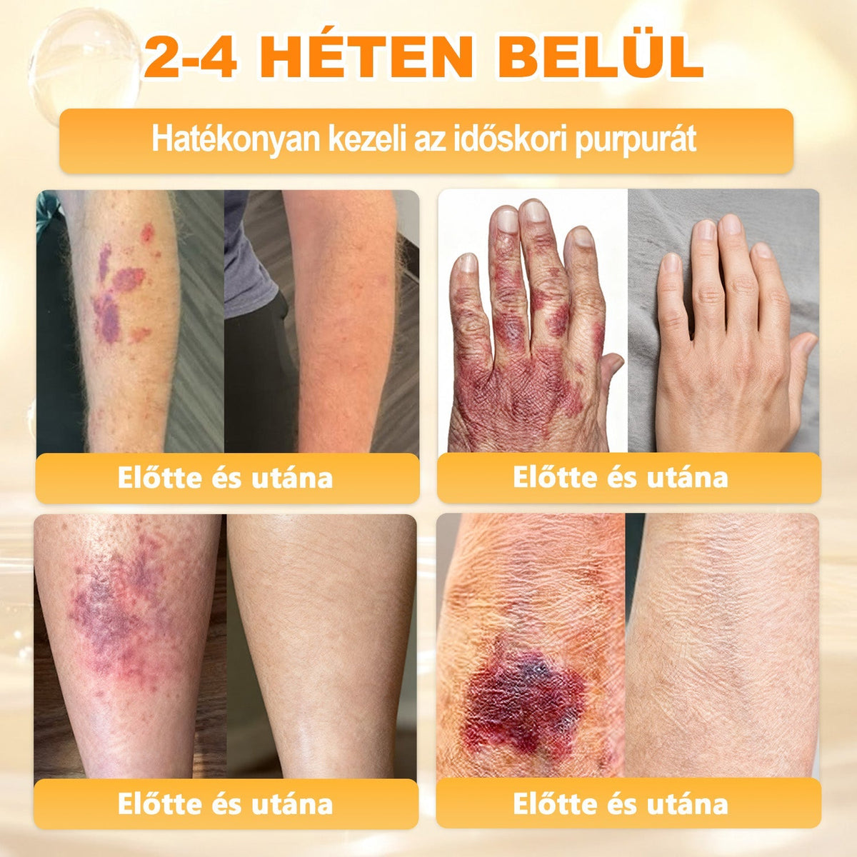 👩‍⚕️👩‍⚕️ 𝐀𝐏𝐊𝐀𝐏𝐊® Természetes Méhméreges Arckrém – gondosan összeállított formula a bőr táplálására, hidratálására és regeneráló ápolására