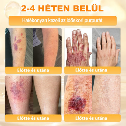 👩‍⚕️👩‍⚕️ 𝐀𝐏𝐊𝐀𝐏𝐊® Természetes Méhméreges Arckrém – gondosan összeállított formula a bőr táplálására, hidratálására és regeneráló ápolására