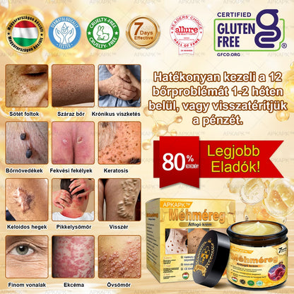 ✨🥇𝐀𝐏𝐊𝐀𝐏𝐊® 𝐌É𝐇𝐌É𝐑𝐄𝐆 Á𝐓𝐅𝐎𝐆Ó 𝐊𝐑É𝐌🥇𝐀 𝐛ö𝐫𝐩𝐫𝐨𝐛𝐥é𝐦á𝐤 𝐤𝐞𝐳𝐞𝐥é𝐬𝐞 𝐦𝐚𝐠á𝐛𝐚𝐧 𝐟𝐨𝐠𝐥𝐚𝐥𝐣𝐚: é𝐥𝐞𝐭𝐤𝐨𝐫𝐢 𝐟𝐨𝐥𝐭𝐨𝐤, 𝐡𝐞𝐠𝐞𝐤, 𝐬𝐳𝐞𝐦ö𝐥𝐜𝐬ö𝐤, 𝐛ö𝐫𝐧ö𝐯𝐞𝐝é𝐤𝐞𝐤, 𝐭á𝐥𝐲𝐨𝐠𝐨𝐤, 𝐩𝐚𝐭𝐭𝐚𝐧á𝐬𝐨𝐤, 𝐞𝐤𝐜é𝐦𝐚, 𝐩𝐬𝐨𝐫𝐢𝐚𝐬𝐢𝐬, 𝐚𝐜𝐧𝐞 𝐢𝐧𝐯𝐞𝐫𝐬𝐚, 𝐫á𝐧𝐜𝐨𝐤, 𝐛ö𝐫ö𝐫𝐞𝐠𝐞𝐝é𝐬 é𝐬 𝐞𝐠𝐲é𝐛 𝐩𝐫𝐨𝐛𝐥é𝐦á𝐤🔥