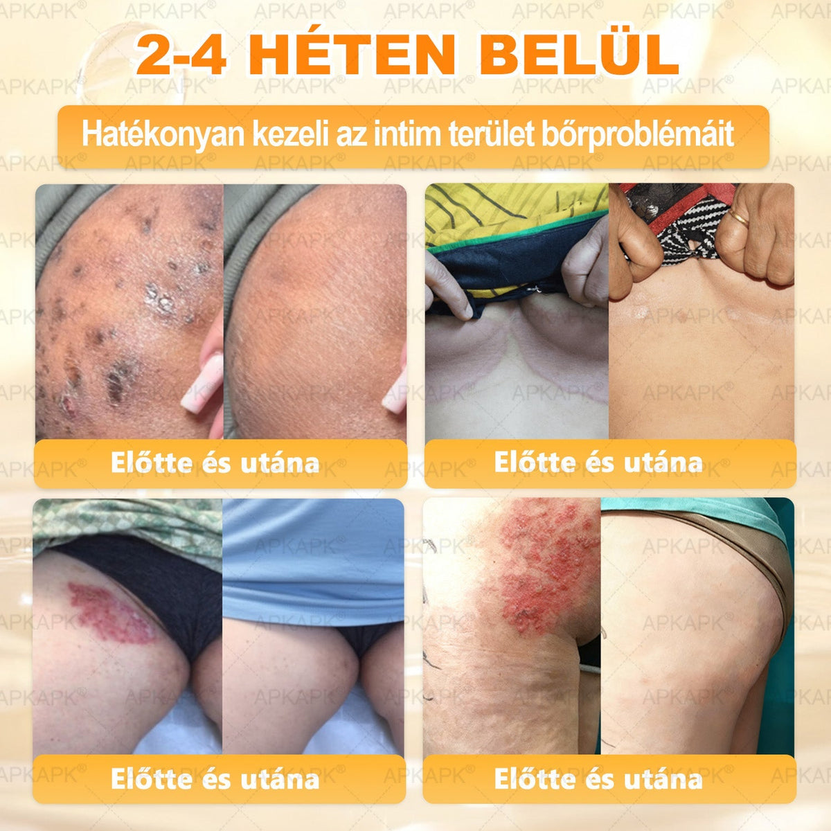 👩‍⚕️👩‍⚕️ 𝐀𝐏𝐊𝐀𝐏𝐊® Természetes Méhméreges Arckrém – gondosan összeállított formula a bőr táplálására, hidratálására és regeneráló ápolására