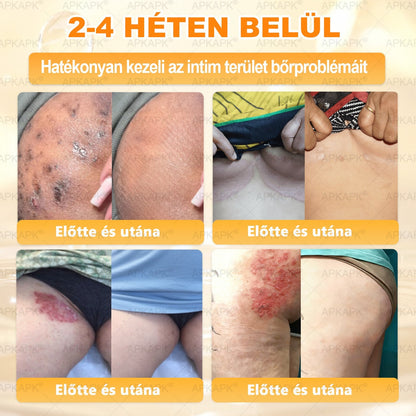 👩‍⚕️👩‍⚕️ 𝐀𝐏𝐊𝐀𝐏𝐊® Természetes Méhméreges Arckrém – gondosan összeállított formula a bőr táplálására, hidratálására és regeneráló ápolására