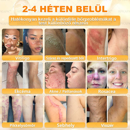 👩‍⚕️👩‍⚕️ 𝐀𝐏𝐊𝐀𝐏𝐊® Természetes Méhméreges Arckrém – gondosan összeállított formula a bőr táplálására, hidratálására és regeneráló ápolására