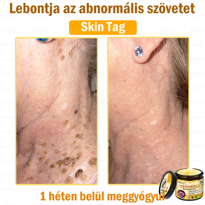 ✨💜💜APKAPK® 𝐌É𝐇𝐌É𝐑𝐄𝐆 Á𝐓𝐅𝐎𝐆Ó 𝐊𝐑É𝐌🥇𝐀 bőrnövedékek 𝐤𝐞𝐳𝐞𝐥é𝐬𝐞 𝐦𝐚𝐠á𝐛𝐚𝐧 𝐟𝐨𝐠𝐥𝐚𝐥𝐣𝐚: é𝐥𝐞𝐭𝐤𝐨𝐫𝐢 𝐟𝐨𝐥𝐭𝐨𝐤, 𝐡𝐞𝐠𝐞𝐤, 𝐬𝐳𝐞𝐦ö𝐥𝐜𝐬ö𝐤, 𝐛ö𝐫𝐧ö𝐯𝐞𝐝é𝐤𝐞𝐤, 𝐭á𝐥𝐲𝐨𝐠𝐨𝐤, 𝐩𝐚𝐭𝐭𝐚𝐧á𝐬𝐨𝐤, 𝐞𝐤𝐜é𝐦𝐚, 𝐩𝐬𝐨𝐫𝐢𝐚𝐬𝐢𝐬, 𝐚𝐜𝐧𝐞 𝐢𝐧𝐯𝐞𝐫𝐬𝐚, 𝐫á𝐧𝐜𝐨𝐤, 𝐛ö𝐫ö𝐫𝐞𝐠𝐞𝐝é𝐬 é𝐬 𝐞𝐠𝐲é𝐛 𝐩𝐫𝐨𝐛𝐥é𝐦á𝐤🔥