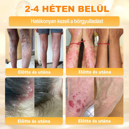 👩‍⚕️👩‍⚕️ 𝐀𝐏𝐊𝐀𝐏𝐊® Természetes Méhméreges Arckrém – gondosan összeállított formula a bőr táplálására, hidratálására és regeneráló ápolására