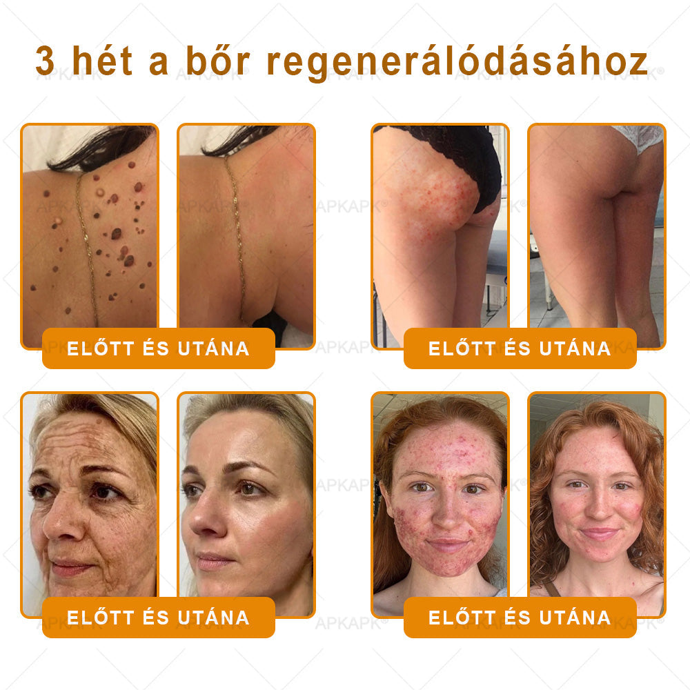 👩‍⚕️👩‍⚕️ 𝐀𝐏𝐊𝐀𝐏𝐊® Természetes Méhméreges Arckrém – gondosan összeállított formula a bőr táplálására, hidratálására és regeneráló ápolására