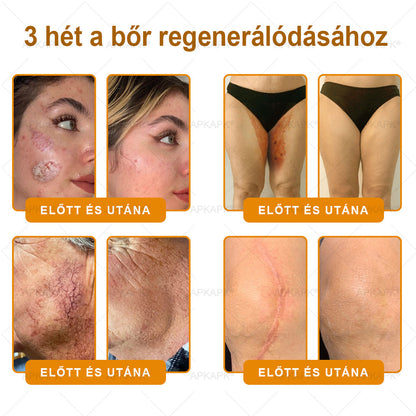 👩‍⚕️👩‍⚕️ 𝐀𝐏𝐊𝐀𝐏𝐊® Természetes Méhméreges Arckrém – gondosan összeállított formula a bőr táplálására, hidratálására és regeneráló ápolására