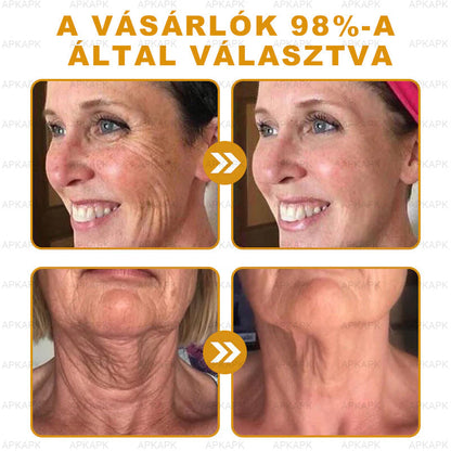 ✨🥇𝐀𝐏𝐊𝐀𝐏𝐊® 𝐌É𝐇𝐌É𝐑𝐄𝐆 Á𝐓𝐅𝐎𝐆Ó 𝐊𝐑É𝐌🥇𝐀 𝐛ö𝐫𝐩𝐫𝐨𝐛𝐥é𝐦á𝐤 𝐤𝐞𝐳𝐞𝐥é𝐬𝐞 𝐦𝐚𝐠á𝐛𝐚𝐧 𝐟𝐨𝐠𝐥𝐚𝐥𝐣𝐚: é𝐥𝐞𝐭𝐤𝐨𝐫𝐢 𝐟𝐨𝐥𝐭𝐨𝐤, 𝐡𝐞𝐠𝐞𝐤, 𝐬𝐳𝐞𝐦ö𝐥𝐜𝐬ö𝐤, 𝐛ö𝐫𝐧ö𝐯𝐞𝐝é𝐤𝐞𝐤, 𝐭á𝐥𝐲𝐨𝐠𝐨𝐤, 𝐩𝐚𝐭𝐭𝐚𝐧á𝐬𝐨𝐤, 𝐞𝐤𝐜é𝐦𝐚, 𝐩𝐬𝐨𝐫𝐢𝐚𝐬𝐢𝐬, 𝐚𝐜𝐧𝐞 𝐢𝐧𝐯𝐞𝐫𝐬𝐚, 𝐫á𝐧𝐜𝐨𝐤, 𝐛ö𝐫ö𝐫𝐞𝐠𝐞𝐝é𝐬 é𝐬 𝐞𝐠𝐲é𝐛 𝐩𝐫𝐨𝐛𝐥é𝐦á𝐤🔥