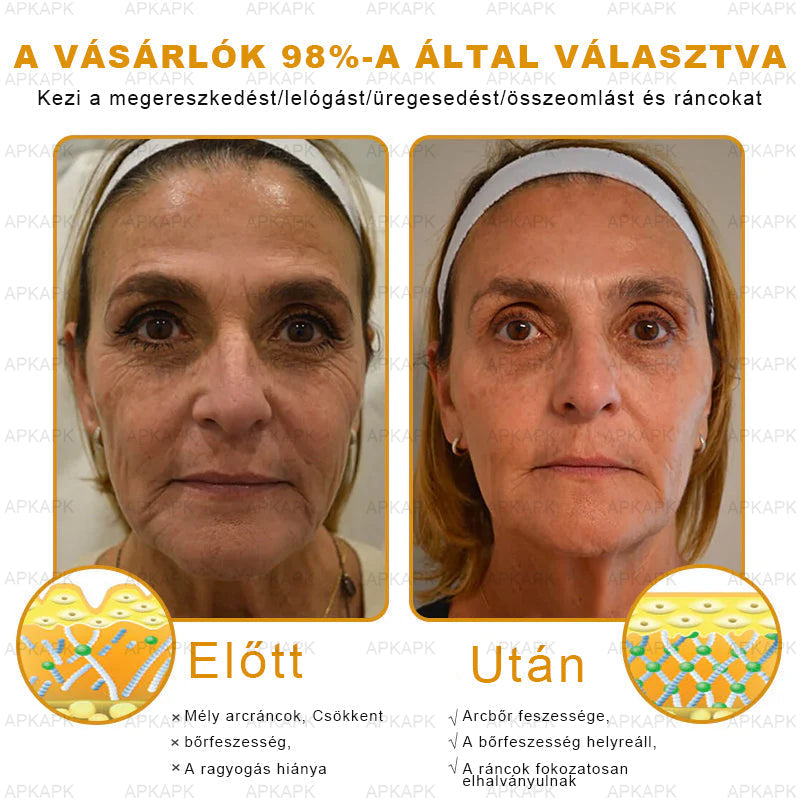 ✨🥇𝐀𝐏𝐊𝐀𝐏𝐊® 𝐌É𝐇𝐌É𝐑𝐄𝐆 Á𝐓𝐅𝐎𝐆Ó 𝐊𝐑É𝐌🥇𝐀 𝐛ö𝐫𝐩𝐫𝐨𝐛𝐥é𝐦á𝐤 𝐤𝐞𝐳𝐞𝐥é𝐬𝐞 𝐦𝐚𝐠á𝐛𝐚𝐧 𝐟𝐨𝐠𝐥𝐚𝐥𝐣𝐚: é𝐥𝐞𝐭𝐤𝐨𝐫𝐢 𝐟𝐨𝐥𝐭𝐨𝐤, 𝐡𝐞𝐠𝐞𝐤, 𝐬𝐳𝐞𝐦ö𝐥𝐜𝐬ö𝐤, 𝐛ö𝐫𝐧ö𝐯𝐞𝐝é𝐤𝐞𝐤, 𝐭á𝐥𝐲𝐨𝐠𝐨𝐤, 𝐩𝐚𝐭𝐭𝐚𝐧á𝐬𝐨𝐤, 𝐞𝐤𝐜é𝐦𝐚, 𝐩𝐬𝐨𝐫𝐢𝐚𝐬𝐢𝐬, 𝐚𝐜𝐧𝐞 𝐢𝐧𝐯𝐞𝐫𝐬𝐚, 𝐫á𝐧𝐜𝐨𝐤, 𝐛ö𝐫ö𝐫𝐞𝐠𝐞𝐝é𝐬 é𝐬 𝐞𝐠𝐲é𝐛 𝐩𝐫𝐨𝐛𝐥é𝐦á𝐤🔥